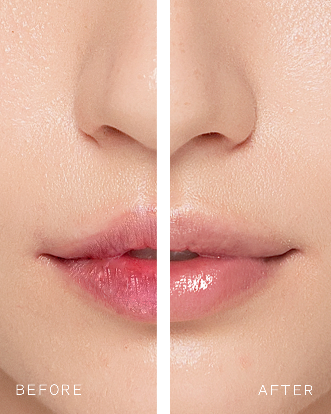 Lip Treatment Repair Mask